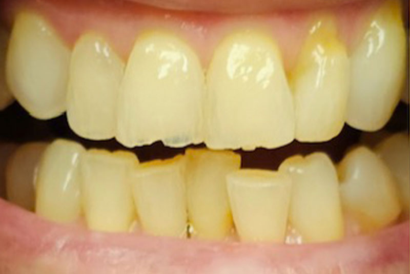 Before