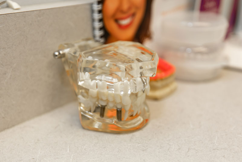 When Others Say No to Dental Implants, Dr. Foust Says “Let’s Find a Way”